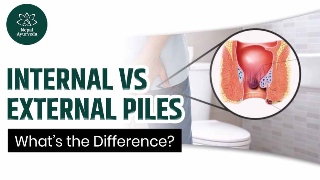 Internal vs External Piles